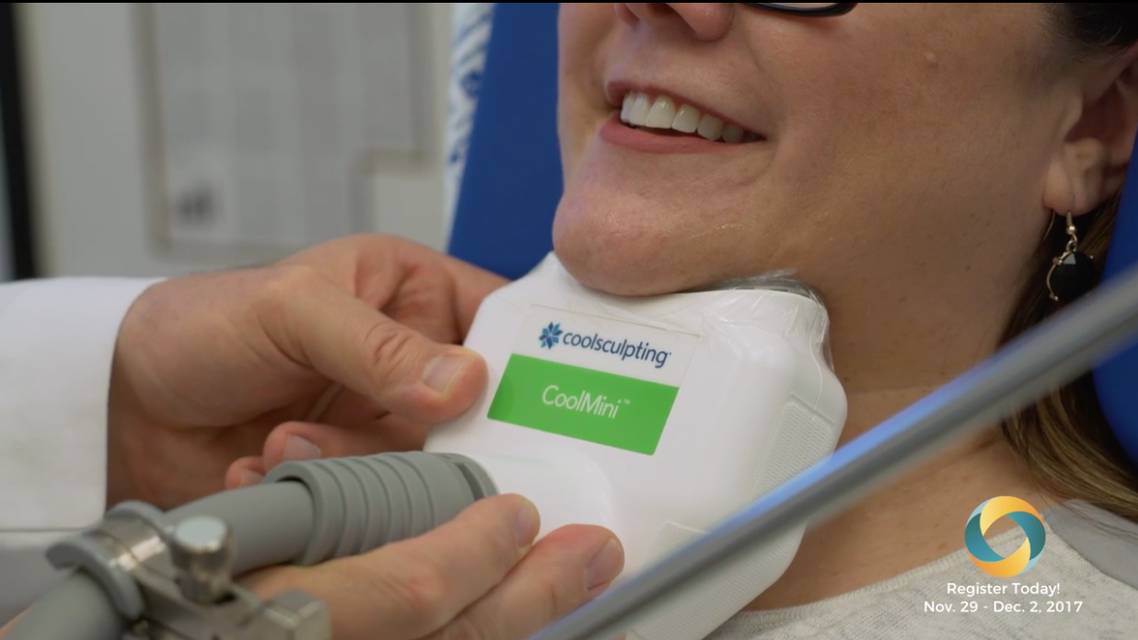 Thumbnail for ltvosate