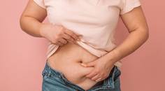 Obese Skin