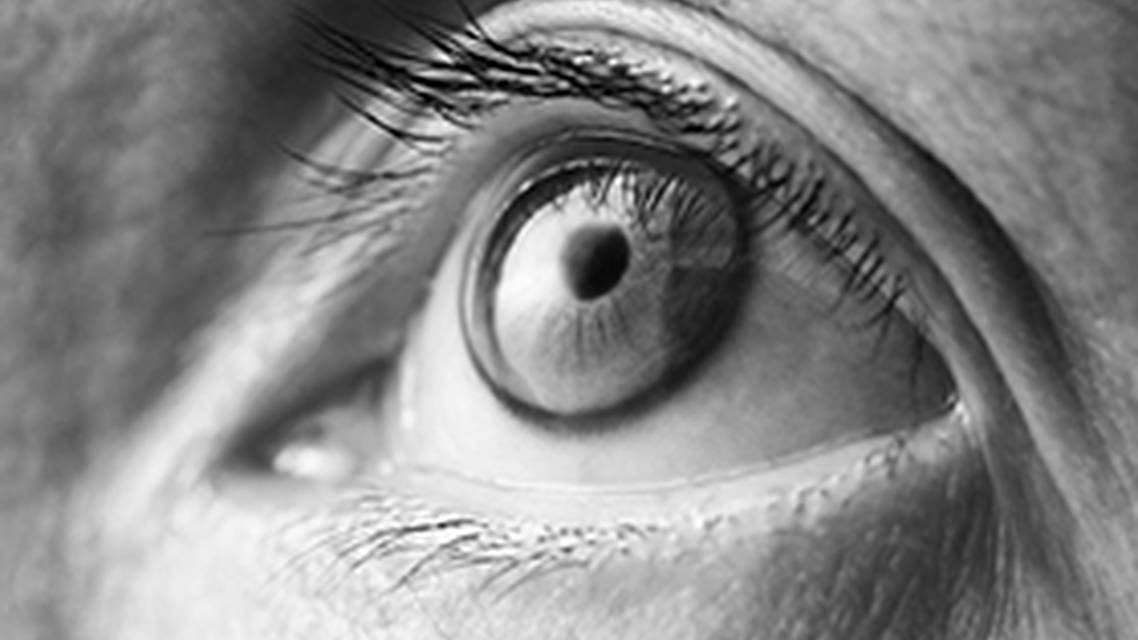 Sublative Radiofrequency Improves Skin Texture and Improves Dry Eyes image