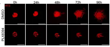 Melanoma and Lung Cancer Drug May Also Treat Cutaneous Squamous Cell Carcinoma image