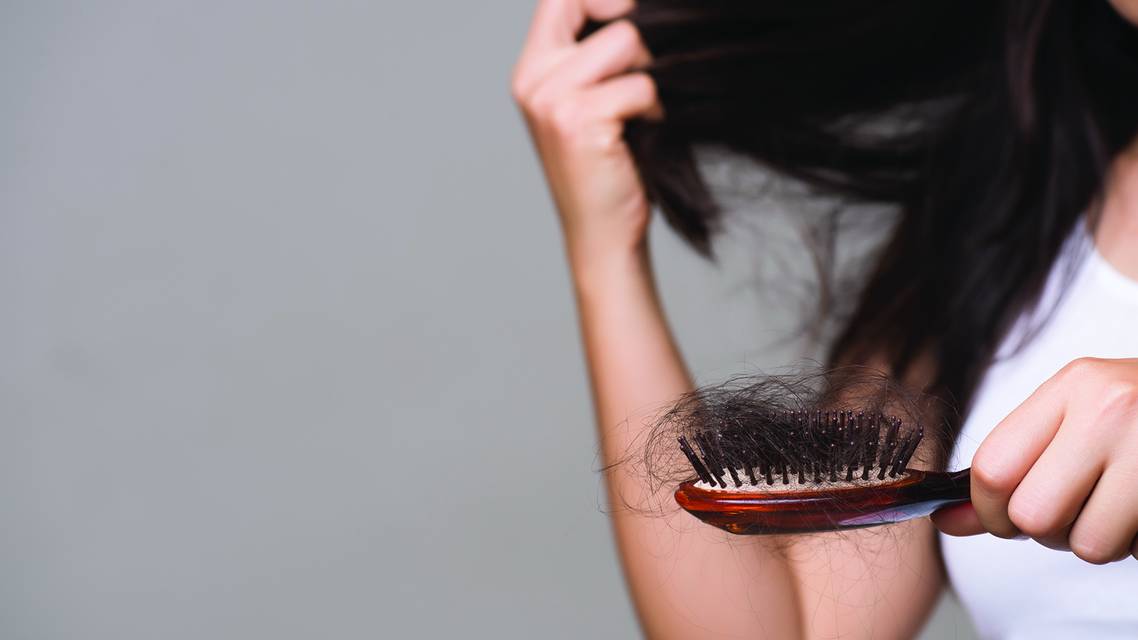 female hair loss