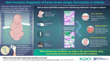 New RNA Monitoring Method May Allow for Early Diagnosis of AD in Infants image