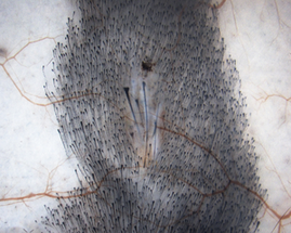 SCUBE3 May Stimulate Hair Growth image