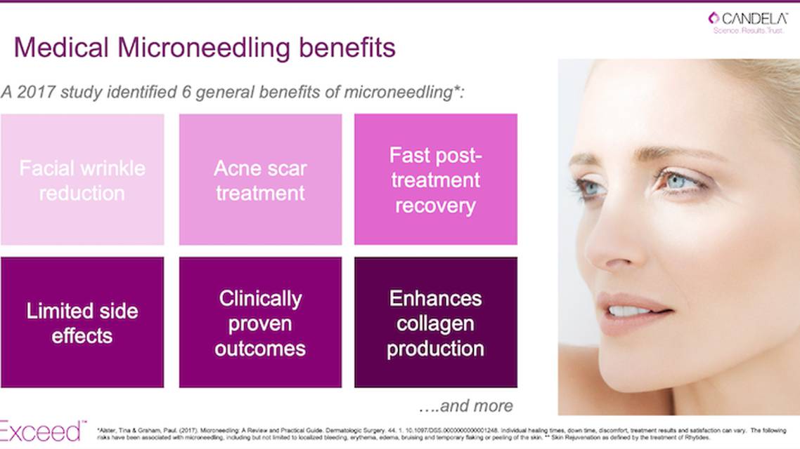 Microneedling  The essential gateway technology for your growing practice thumbnail