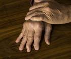psoriasis