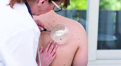Exploring All Options for Treating Nonmelanoma Skin Cancer