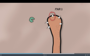 Demystifying Itch Does S aureus Kickstart a Molecular Chain Reaction that Culminates in the Urge to Scratch image