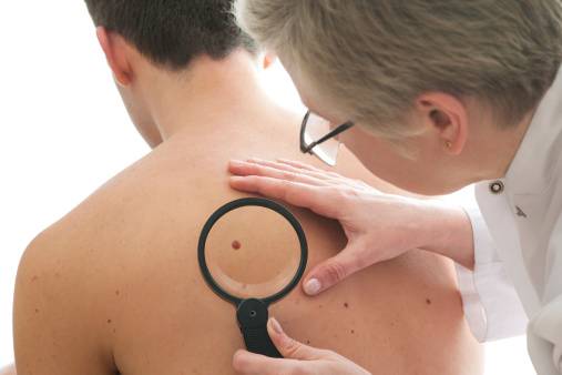 Skin Cancer 2024 Trends and Updates