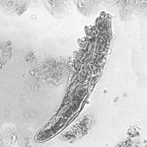 Chicken or the Egg Unravelling the Role of Demodex in Rosacea image