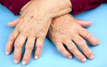 Can Blocking the Function of the CCR6 Chemokine Help Treat Psoriasis and Psoriatic Arthritis image