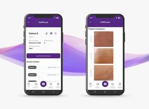 Swiftscope
