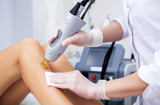 Laser hair removal