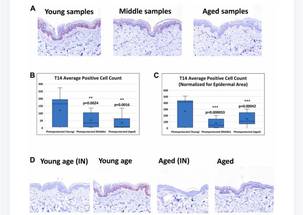 Novel Peptide T14 May Reflect Age and Photoaging in Human Skin image
