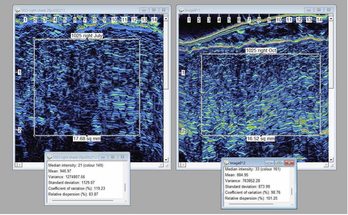 Epigenetic Mechanisms Activated by GHKCu Increase Skin Collagen Density image