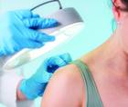dermatology images