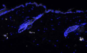 Does IL17 Play a Role in Skin Aging image