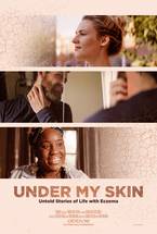 AbbVie Enters Doc Film Biz Company Releases New Film on Living with Eczema image