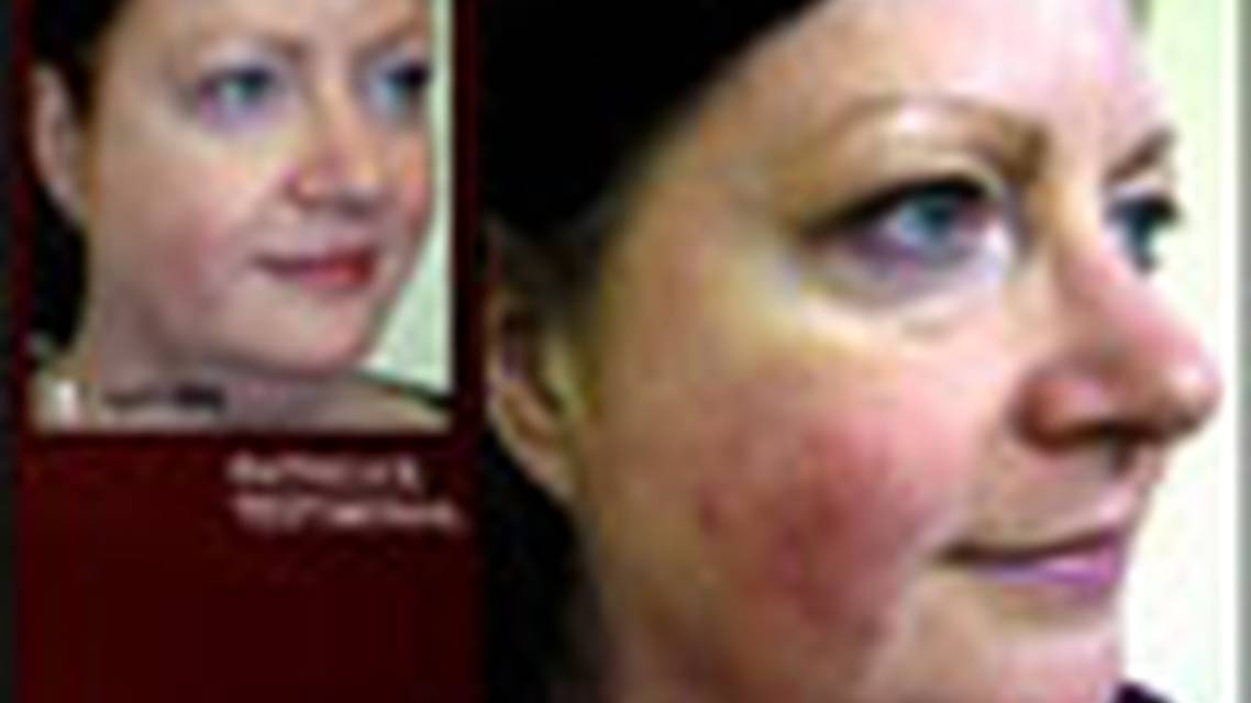 Thumbnail for galasigi