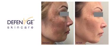 DefenAge Receives Two US Patents For Melasma and Hair Growth image