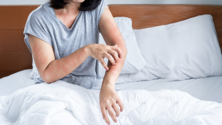 Beyond the Flare: Choosing the Right Systemic in Moderate-to-Severe Atopic Dermatitis